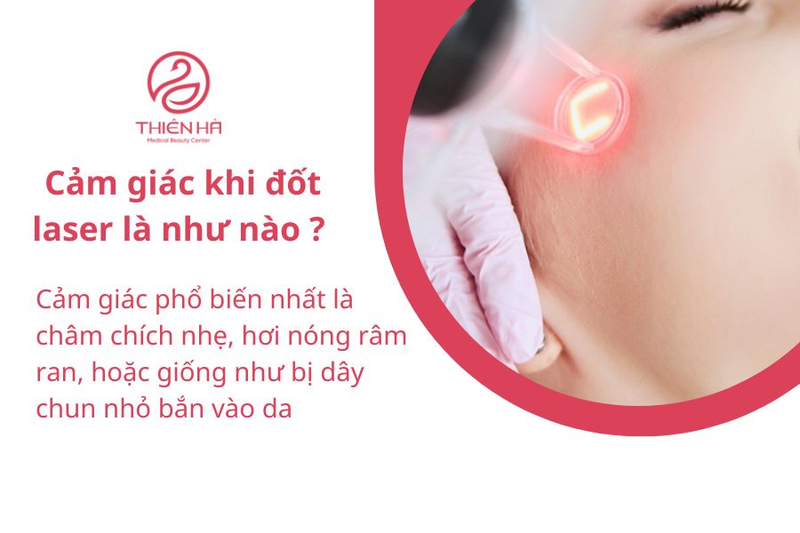 Cảm giác khi đốt laser