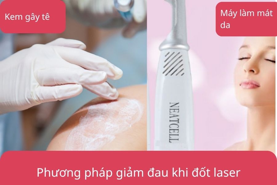 Các phương pháp giảm đau khi đốt laser