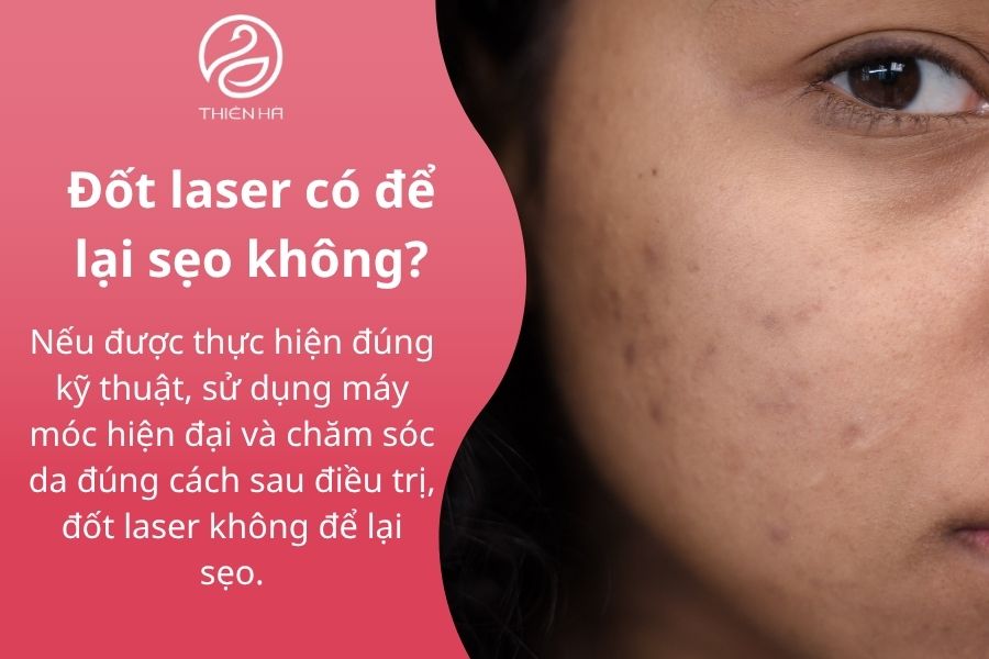 Những câu hỏi thường gặp về việc đốt laser có đau không?