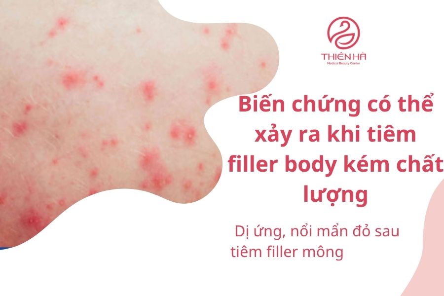 Biến chứng tiêm filler body kém chất lượng