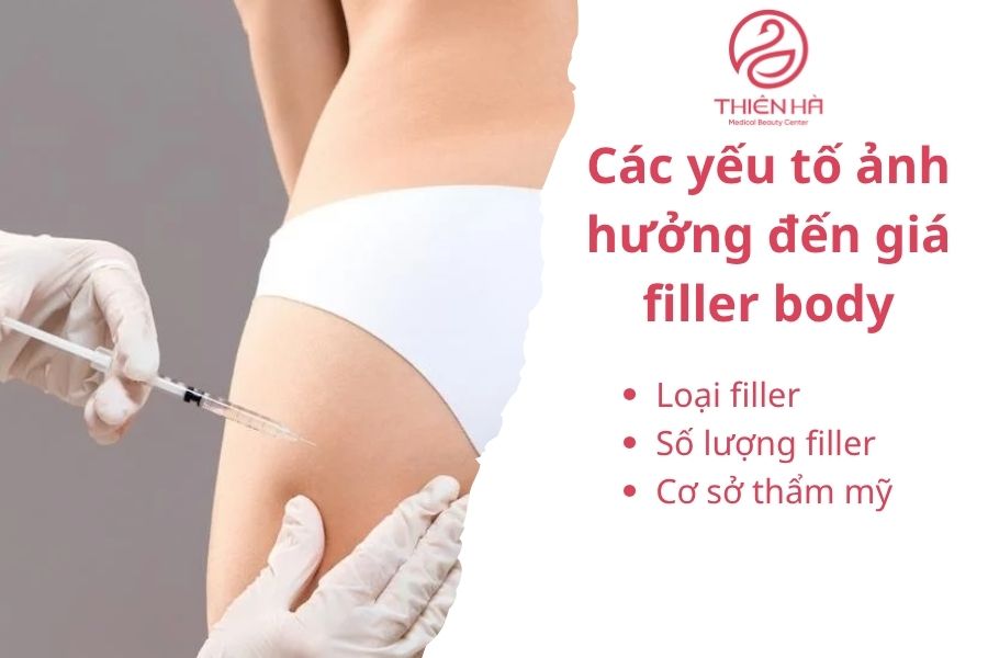 Các yếu tố ảnh hưởng đến giá filer body