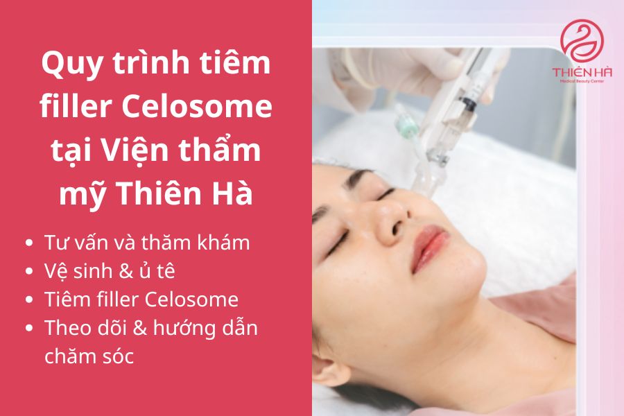 Các bước trong quy trình tiêm filler