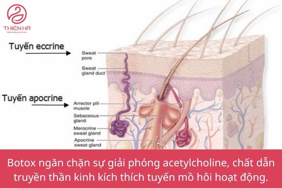 Cơ chế hoạt động của Botox trị mồ hôi tay