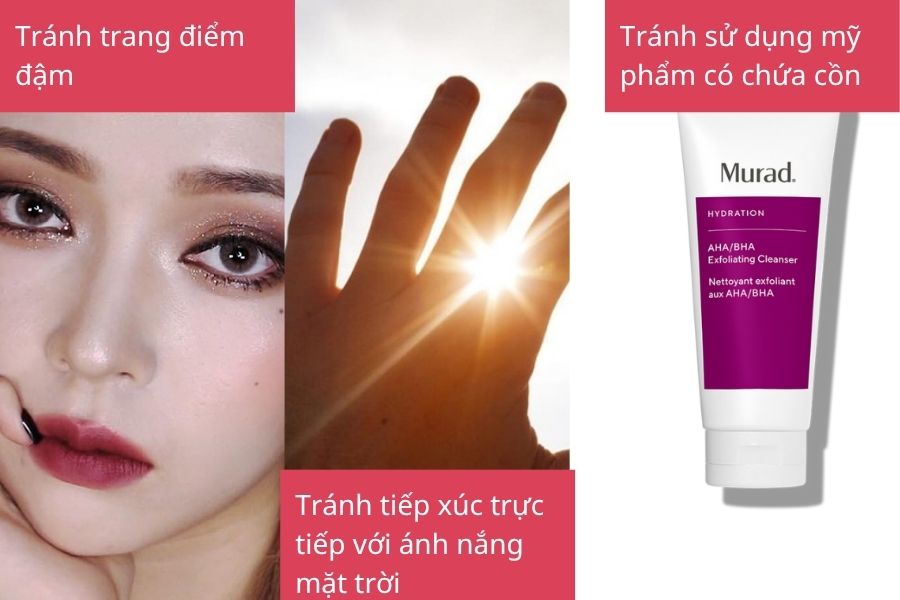 Những điều cần tránh sau bắn laser