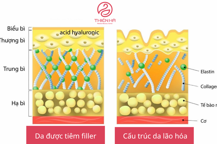 Cấu trúc da lão hóa và da được tiêm filler