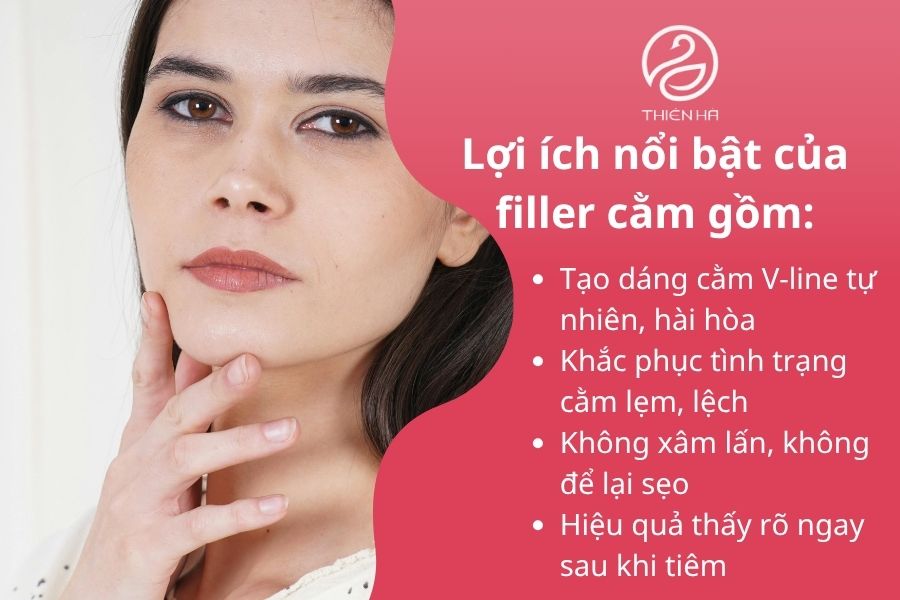 Lợi ích của filler cằm 