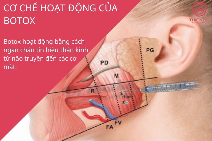 Botox hoạt động như nào ? 