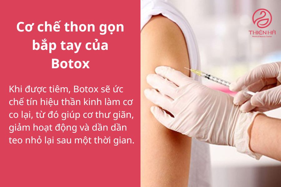 Botox ức chế hoạt động của cơ, giúp bắp tay nhỏ gọn hơn.