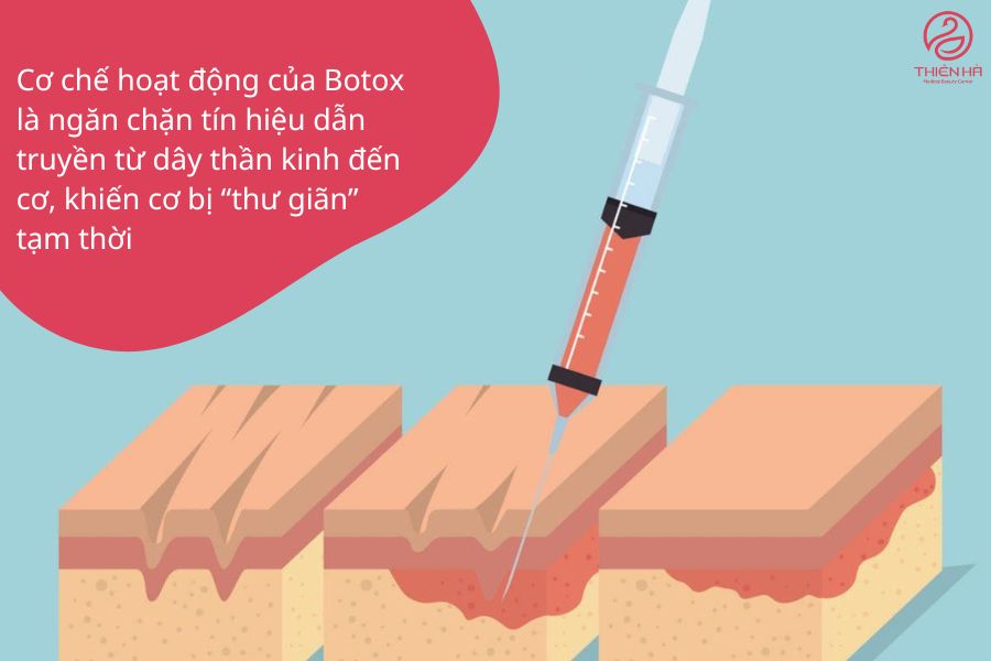 Sơ đồ minh họa cơ chế hoạt động của Botox trên cơ mặt