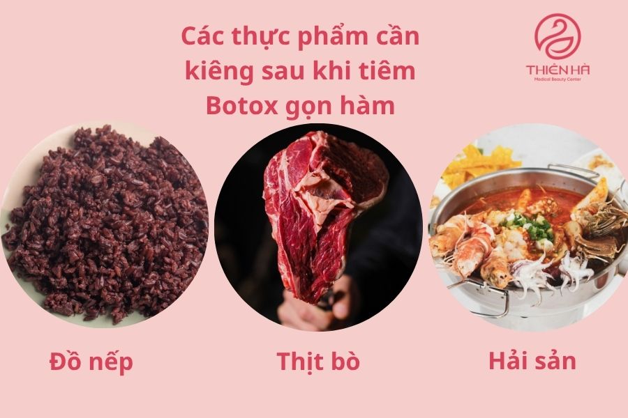 Các thực phẩm cần kiêng sau khi tiêm Botox gọn hàm