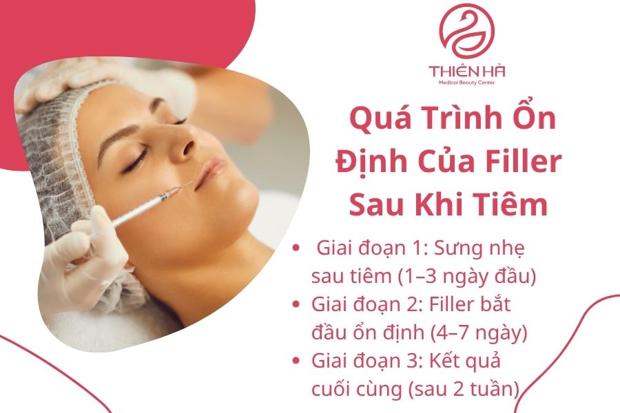 Quá Trình Ổn Định Của Filler Sau Khi Tiêm