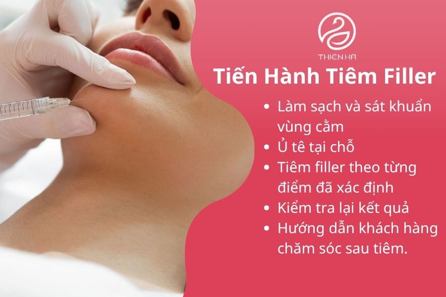 Quy trình tiêm filler cằm chuẩn y khoa