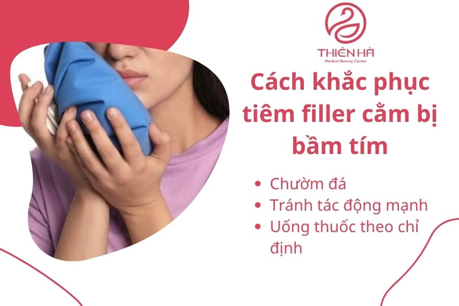 Chườm đá đúng cách giúp giảm sưng bầm sau tiêm filler