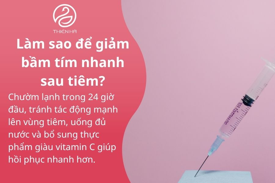 Một số câu hỏi thường gặp