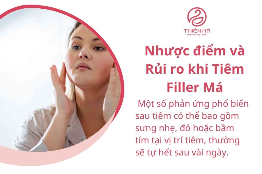Nhược điểm và Rủi ro khi Tiêm Filler Má