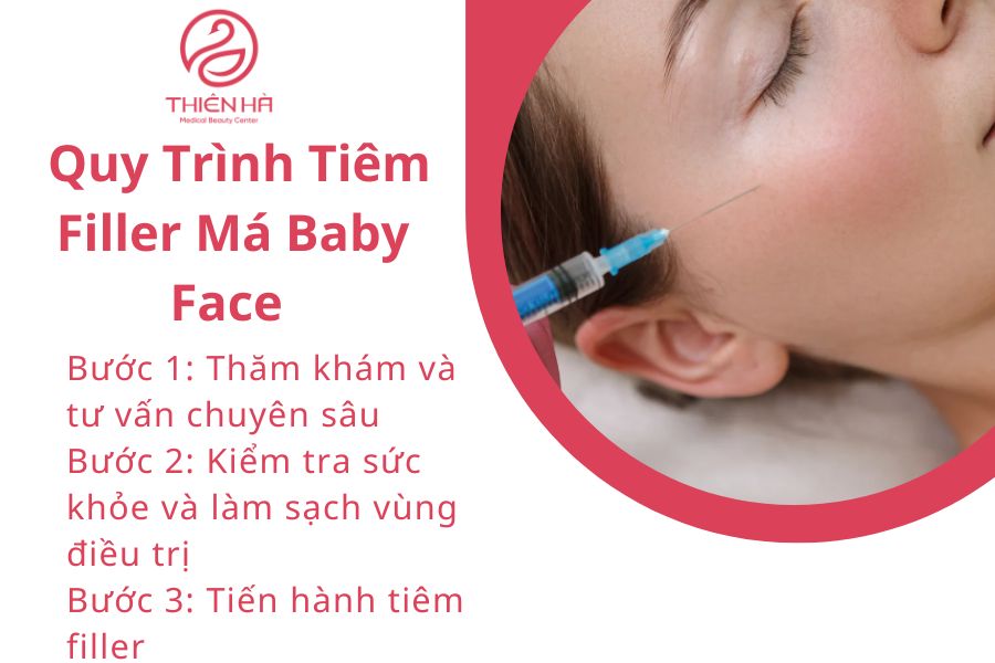 Quy trình tiêm filler má an toàn chuẩn y khoa