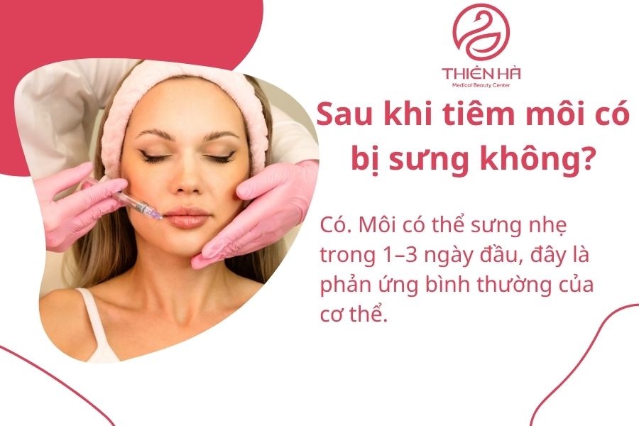Câu hỏi thường gặp