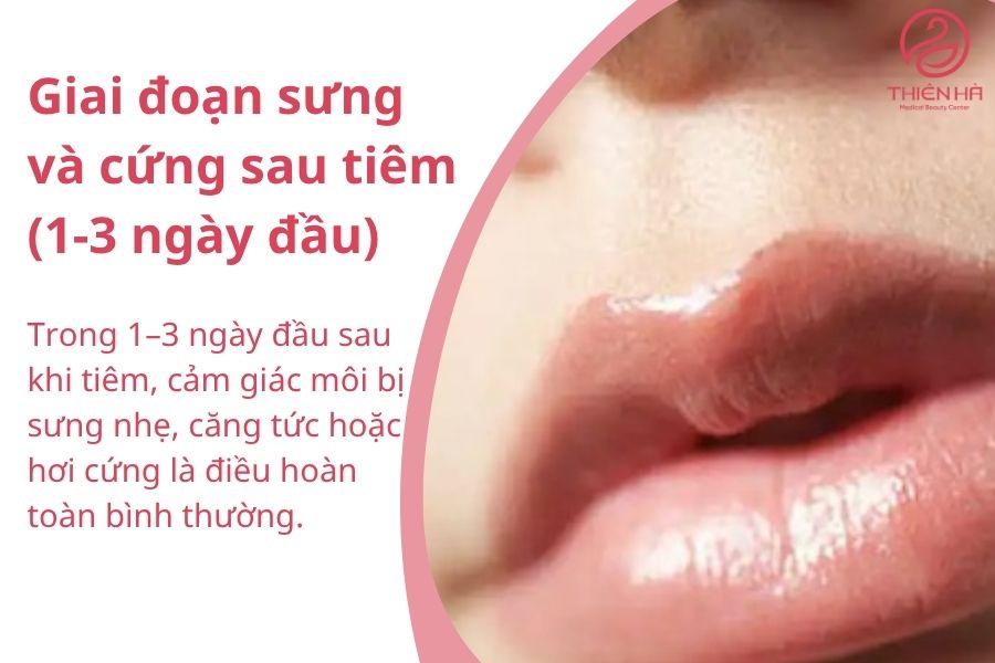 Môi sưng nhẹ sau khi tiêm filler.