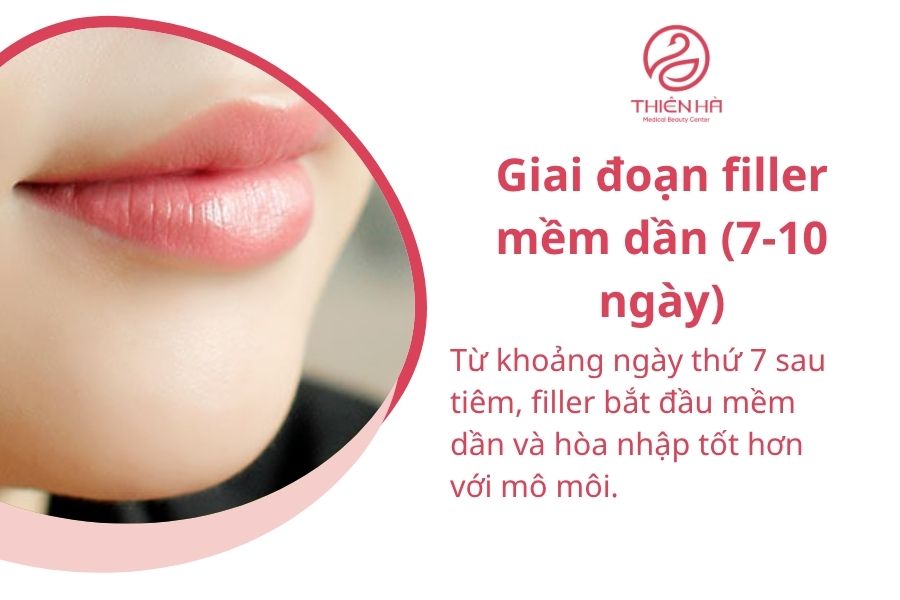 Môi mềm mại, tự nhiên sau 7-10 ngày tiêm filler.