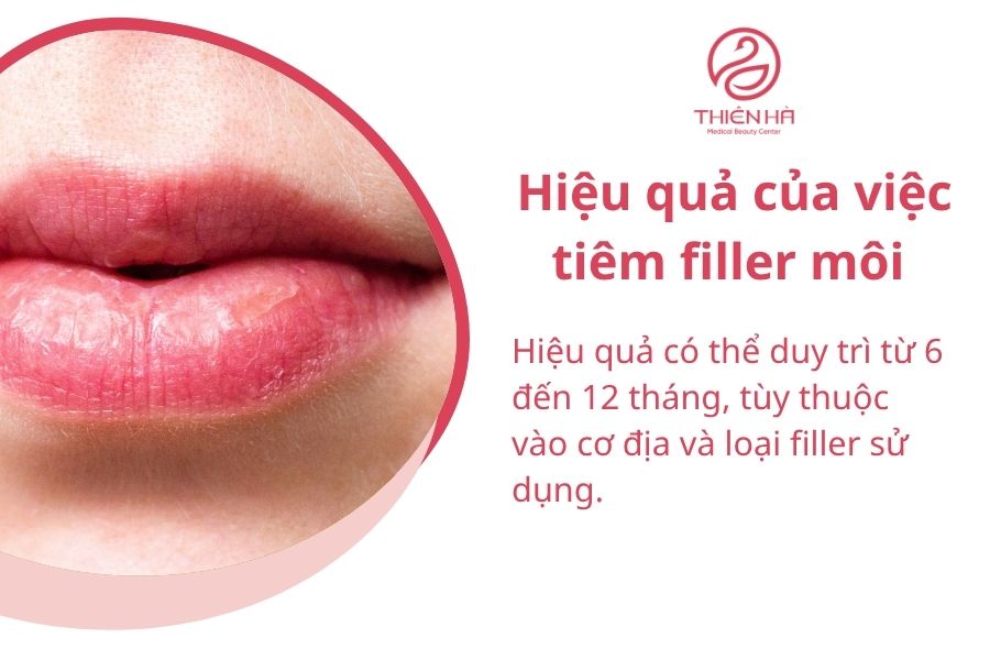 Hiệu quả của việc tiêm filler môi 