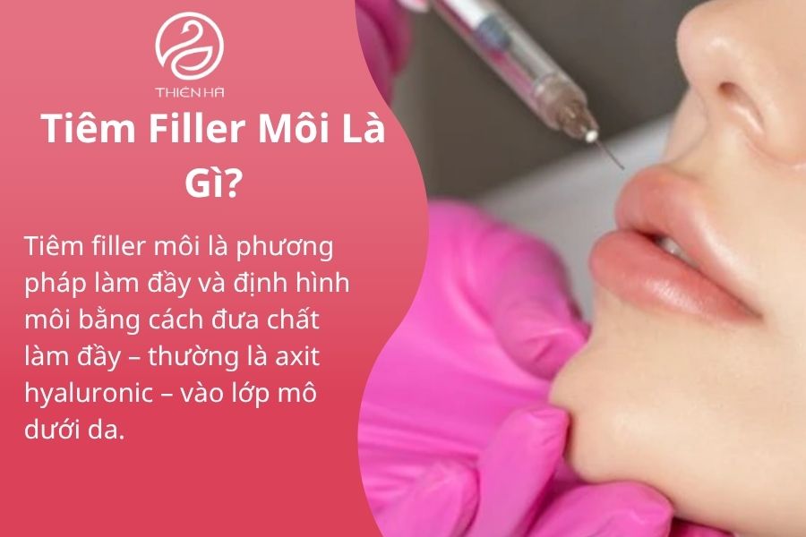  Tiêm Filler Môi Là Gì?