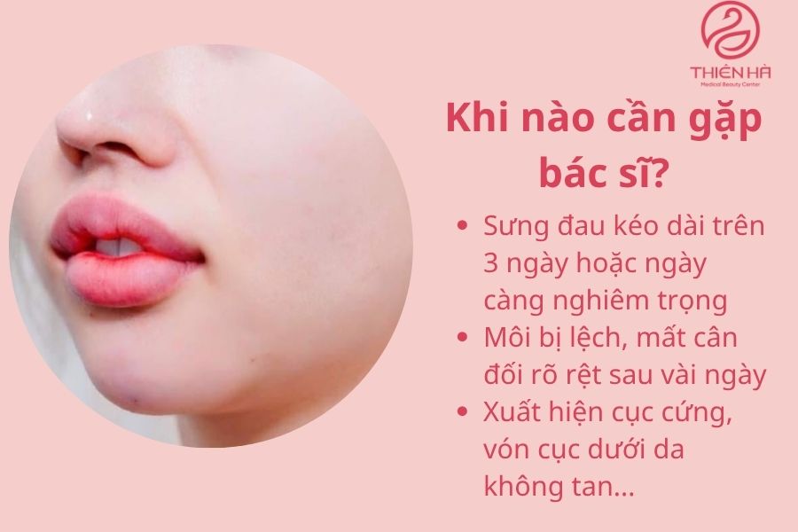 Filler bị vón cục