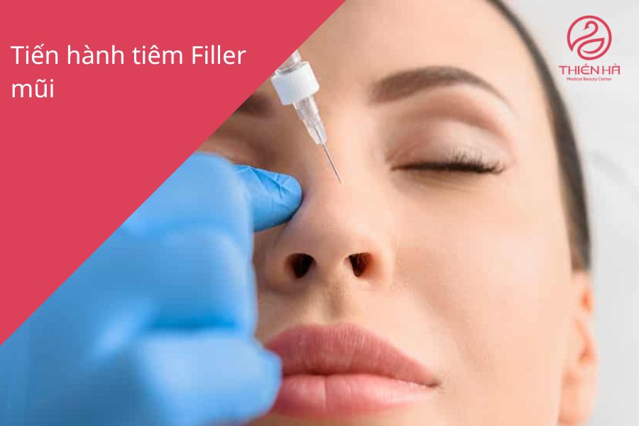 Quá trình tiêm filler mũi được thực hiện bởi bác sĩ có tay nghề cao tại TMV Thiên Hà