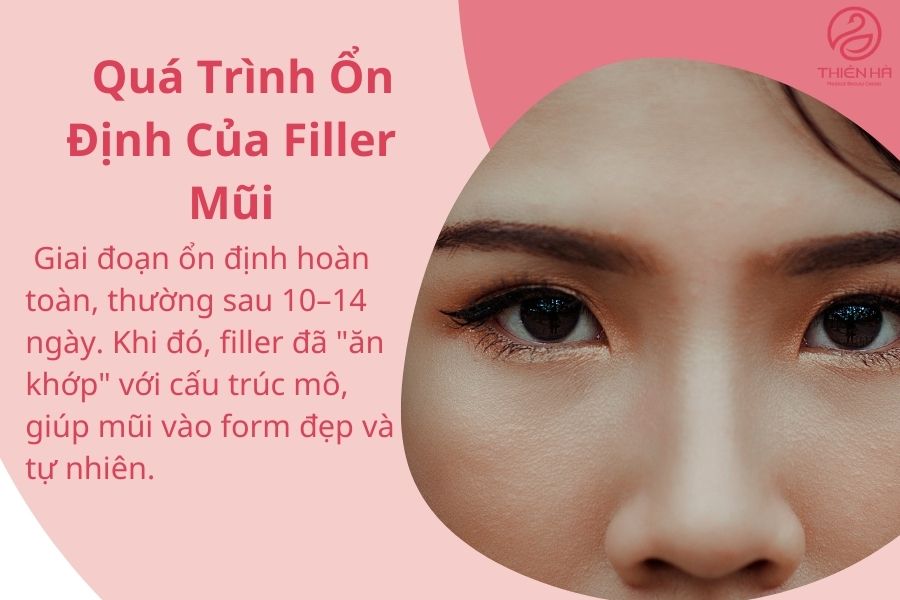 Quá Trình Ổn Định Của Filler Mũi