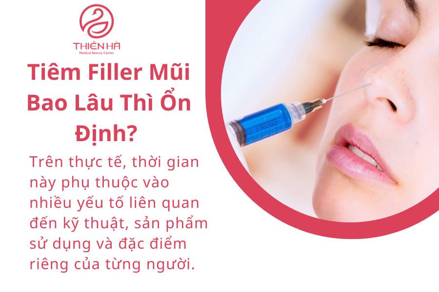Tiêm Filler Mũi Bao Lâu Thì Ổn Định?