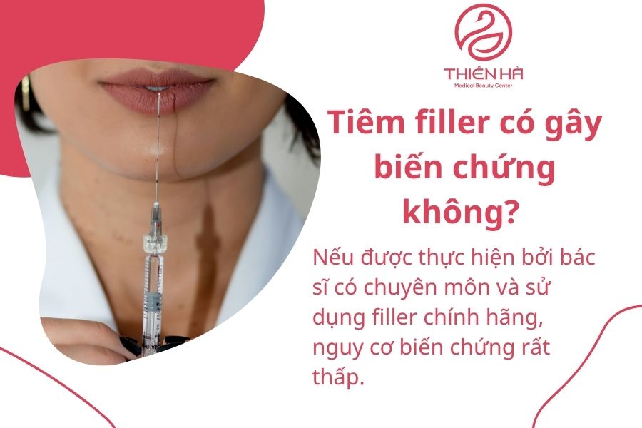 Một số câu hỏi thường gặp
