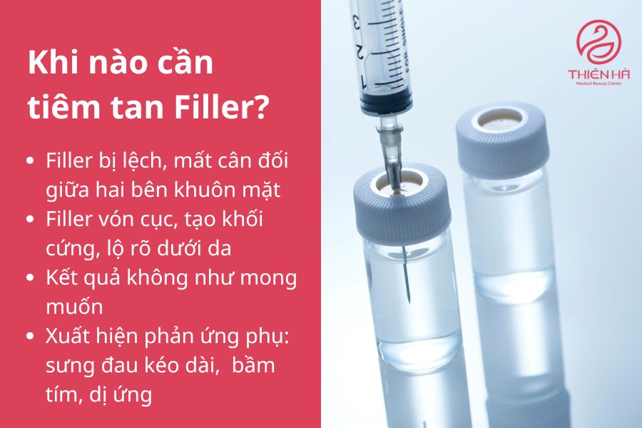Các trường hợp cần tiêm tan filler 