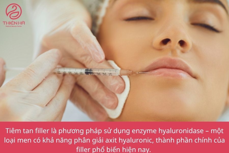 Tiêm tan filler là gì
