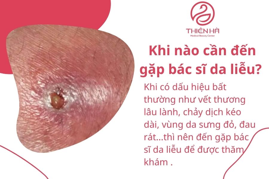 Dấu hiệu cần đến gặp bác sĩ 