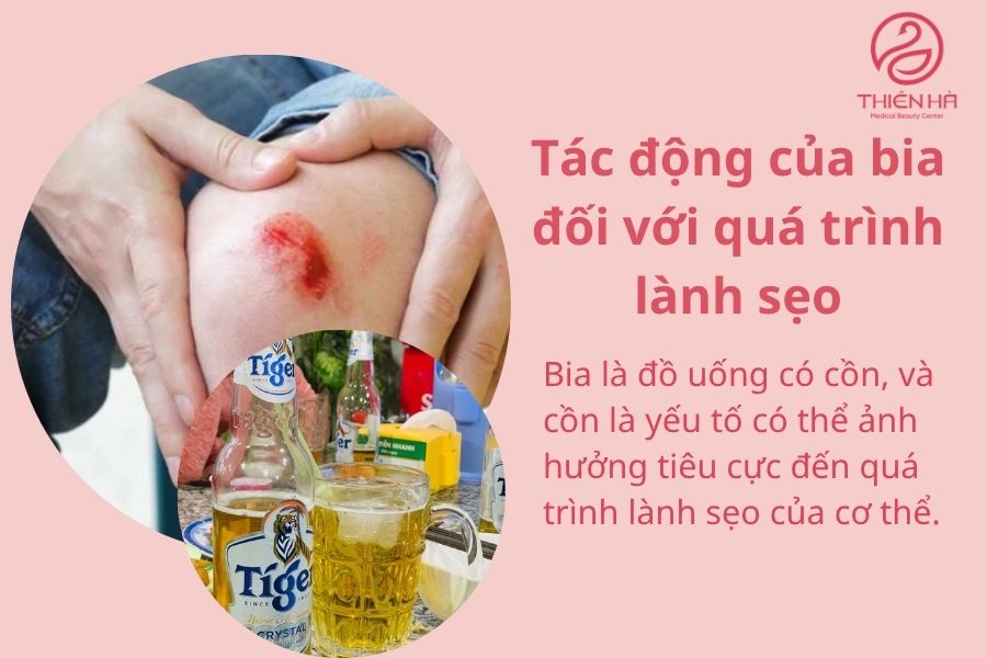  Tác động của bia đối với quá trình lành sẹo