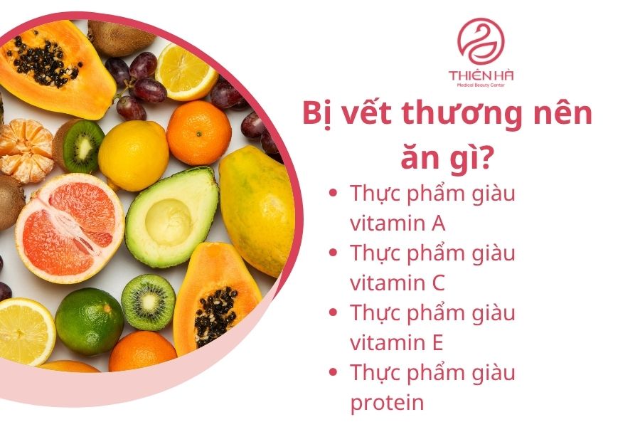 Bị vết thương nên ăn gì?