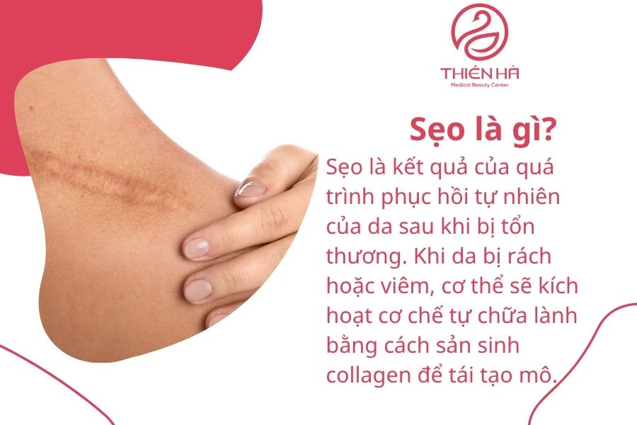 Sẹo là gì?