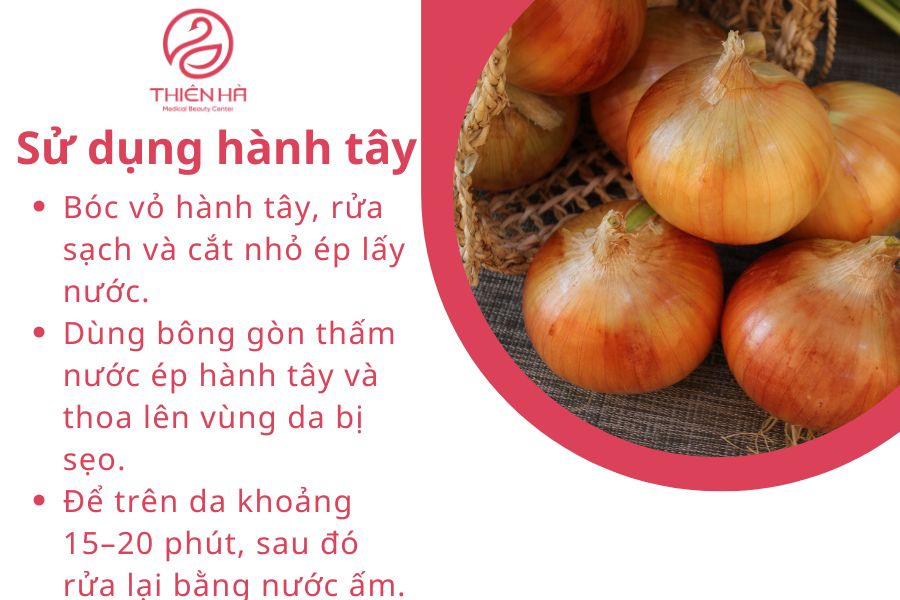 Sử dụng hành tây làm mờ sẹo