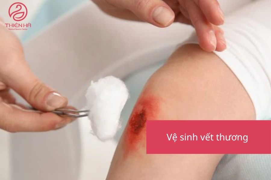 Vệ sinh vết thương