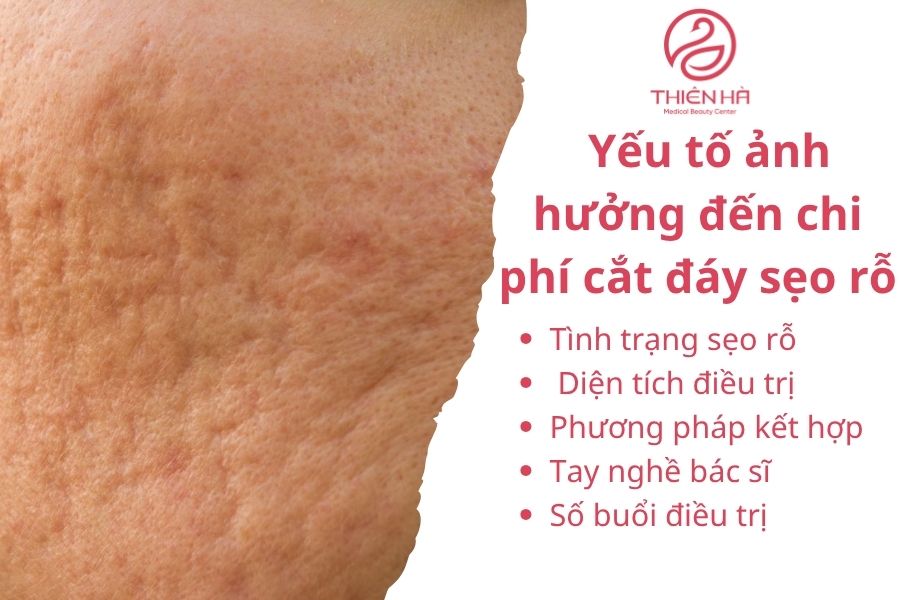 Yếu tố ảnh hưởng đến chi phí cắt đáy sẹo rỗ