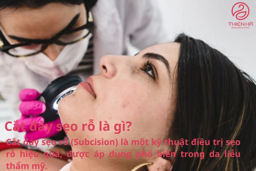 Phương pháp cắt đáy sẹo rỗ là gì?