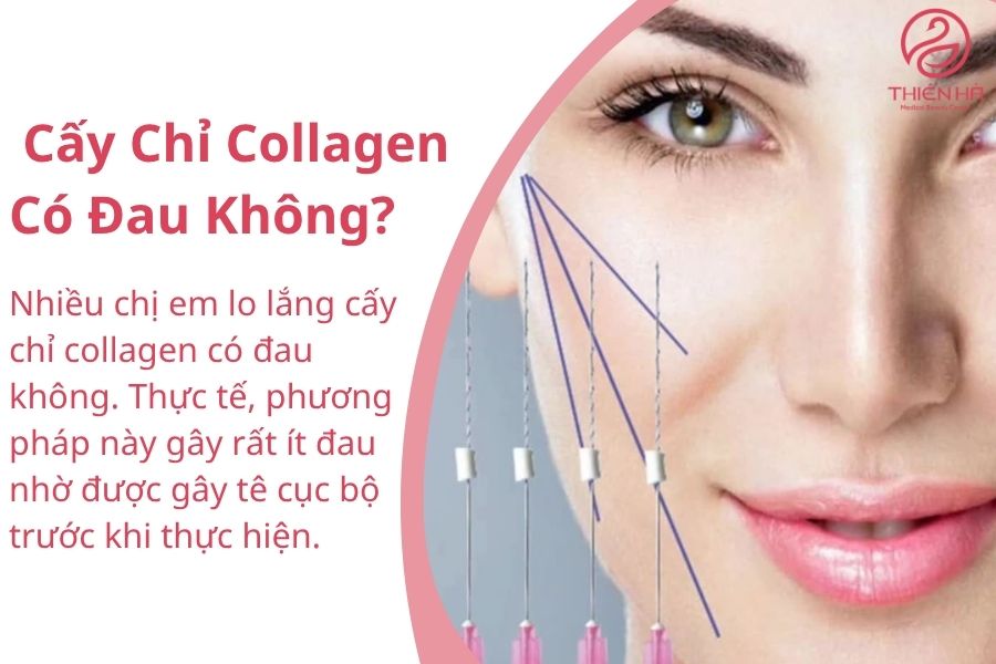 Cấy Chỉ Collagen Có Đau Không?