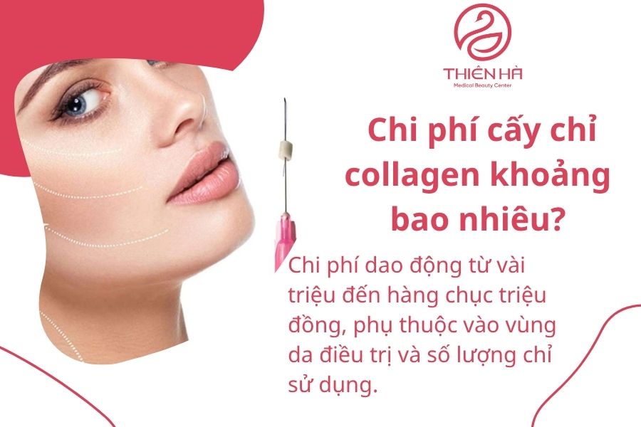 Một số câu hỏi thường gặp 
