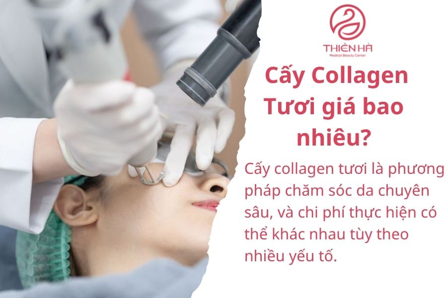 Cấy Collagen Tươi giá bao nhiêu?
