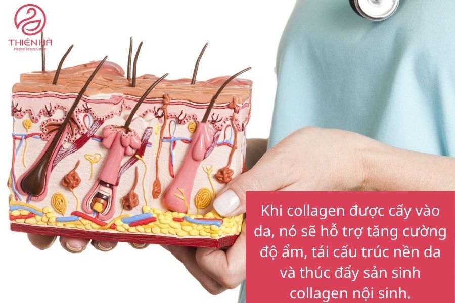 Sơ đồ cấu trúc da 