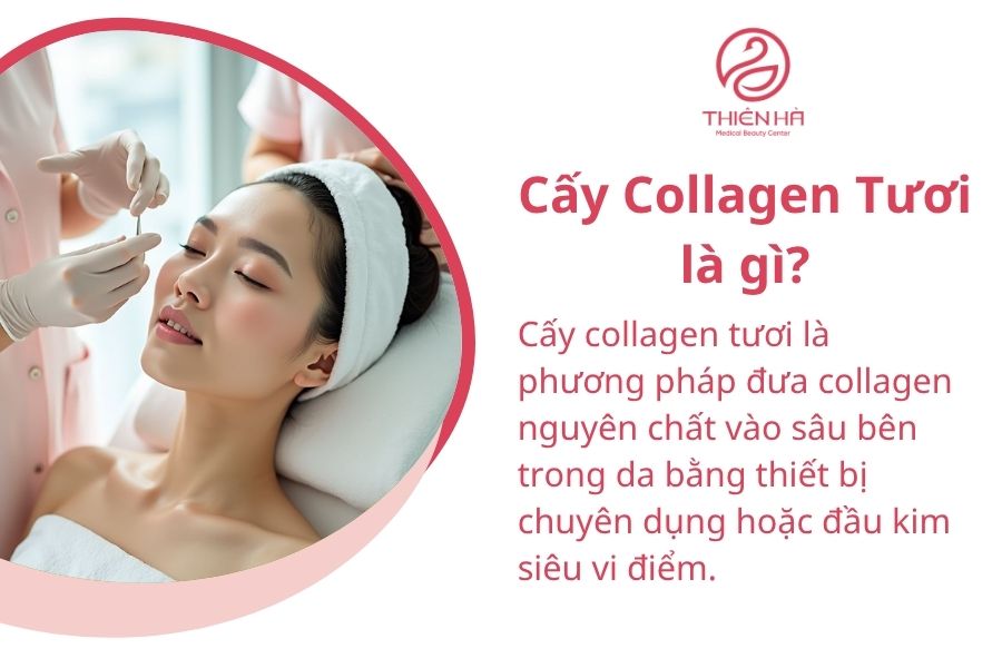 Cấy Collagen Tươi là gì?