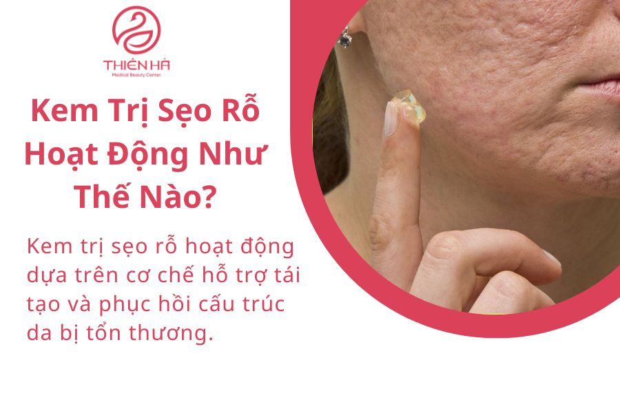 Cơ chế hoạt động của kem trị sẹo rỗ