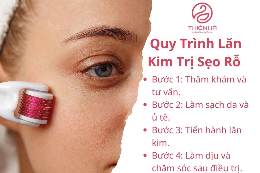 Quy Trình Lăn Kim Trị Sẹo Rỗ