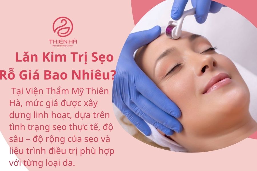 Lăn Kim Trị Sẹo Rỗ Giá Bao Nhiêu?