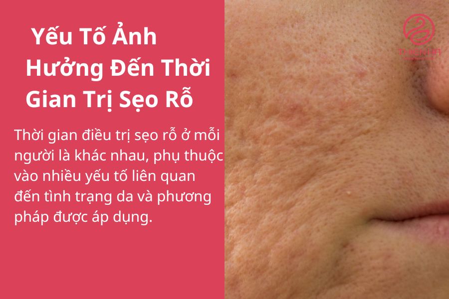 Các Yếu Tố Ảnh Hưởng Đến Thời Gian Trị Sẹo Rỗ