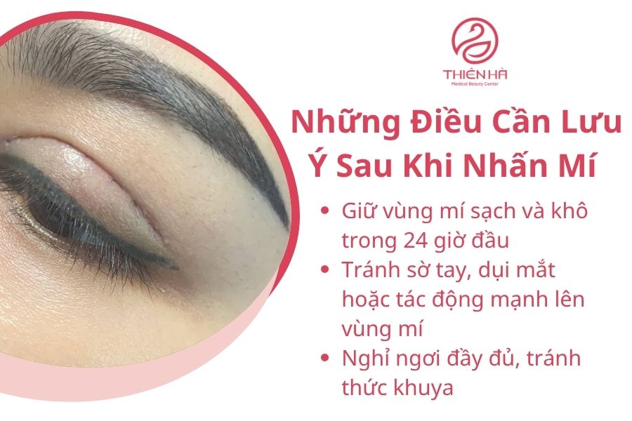 Những Điều Cần Lưu Ý Sau Khi Nhấn Mí
